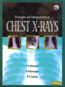 Orient Principles and Interpretation of Chest X-rays